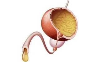 Что такое простаторея у мужчин (дефекационная и микционная)