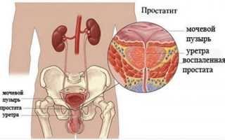 Причины простатита у подростков: симптоматика, методы лечения