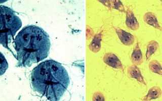 Вопросы лечения и профилактики лямблиоза у взрослых