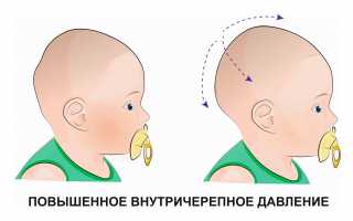 Повышенное внутричерепное давление у детей