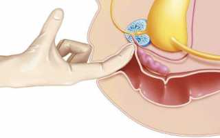 Техника проведения массажа простаты пальцем женой для мужа дома