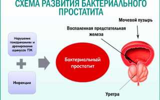 Что такое бактериальный простатит (бактерии в предстательной железе)