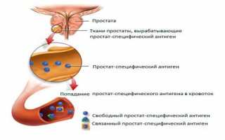 Как делают анализ ПСА общий при простатите и какая норма его уровня