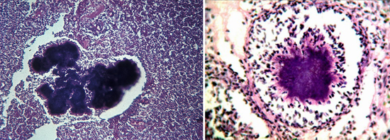 на фото actinomyces