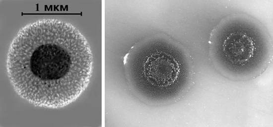 колонии возбудителей