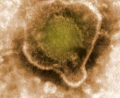 вирус под микроскопом ЭБВИ